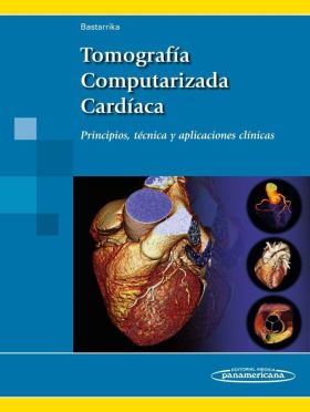 Tomog.Computar. Cardaca
