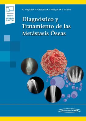 Diagnóstico y Tratamiento de las Metástasis Óseas ebook