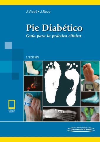 Pie Diabético