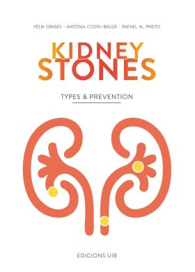 Kidney Stones