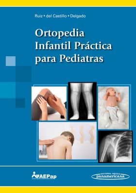 Ortopedia Infantil Práctica para Pediatras (eBook online)