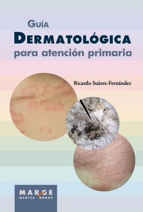 Guía dermatológica para atención primaria