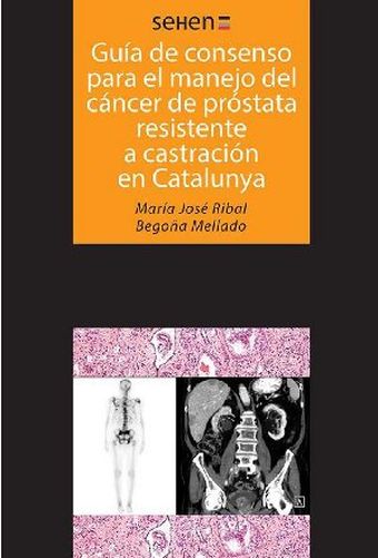 Guías de consenso para el manejo del cáncer de próstata resistente a castración 