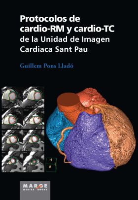 Protocolos de cardio-RM y cardio-TC de la Unidad de Imagen Cardiaca Sant Pau