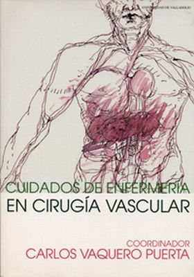 CUIDADOS DE ENFERMERÍA EN CIRUGÍA VASCULAR