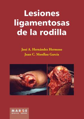 Lesiones ligamentosas de rodilla