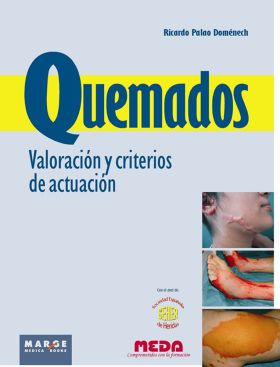 Quemados. Valoración y criterios de actuación