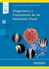 Diagnóstico y Tratamiento de las Metástasis Óseas ebook