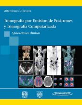 Tomografía por Emisión de Positrones y Tomografía Computarizada