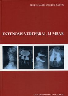 ESTENOSIS VERTEBRAL LUMBAR