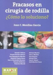 Fracasos en cirugía de rodilla ¿Cómo lo soluciono?