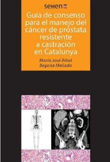 Guías de consenso para el manejo del cáncer de próstata resistente a castración 